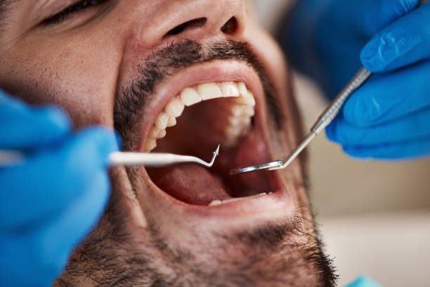 Best Broken or Cracked Tooth Emergency Dentist in Geneva, IN